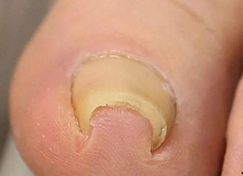 成人剪指甲视频大全集,成人剪指甲视频大全集精华解析  第3张